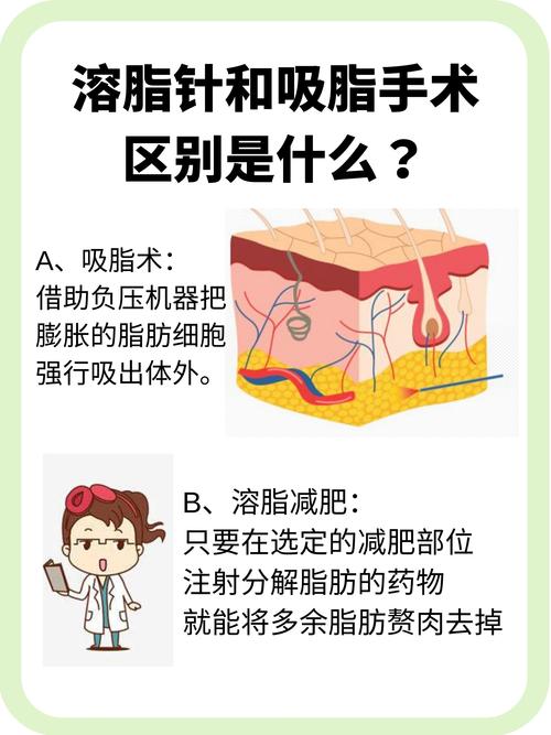 溶脂针注射方法揭秘：掌握溶脂针注射技巧 轻松瘦身