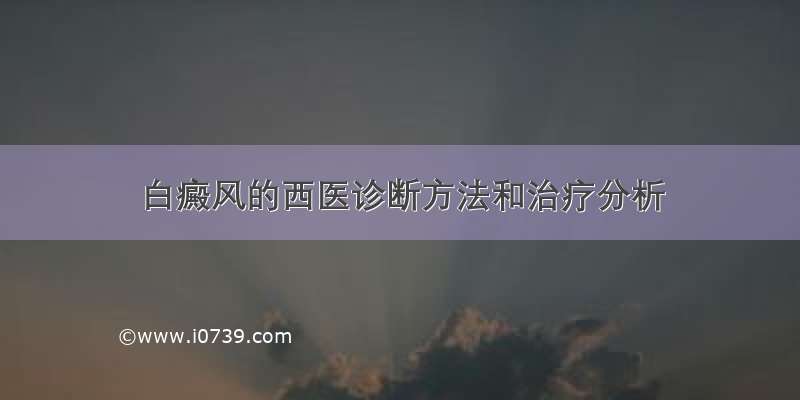 白癜风的西医诊断方法和治疗分析